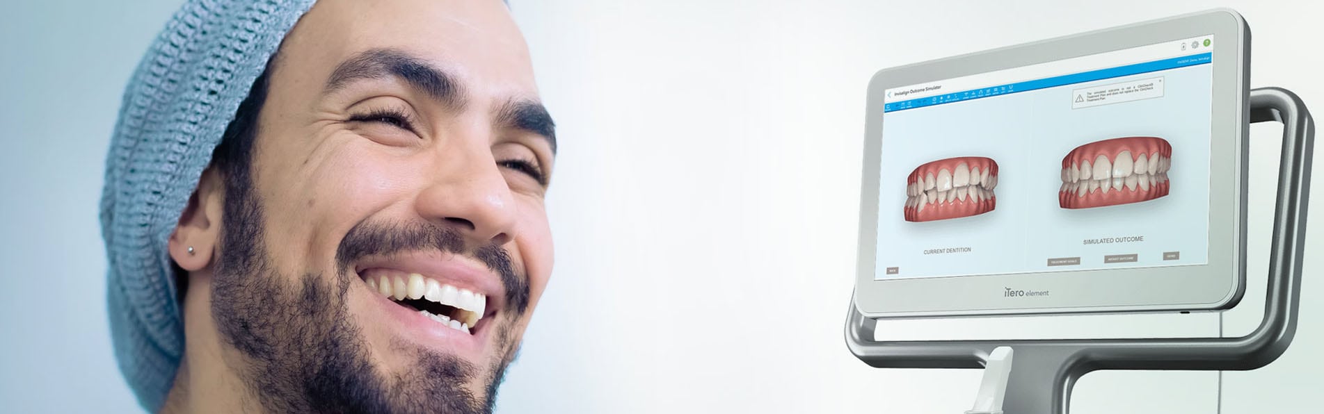 Mann lacht neben einem itero scanner das seine zähne zeigt